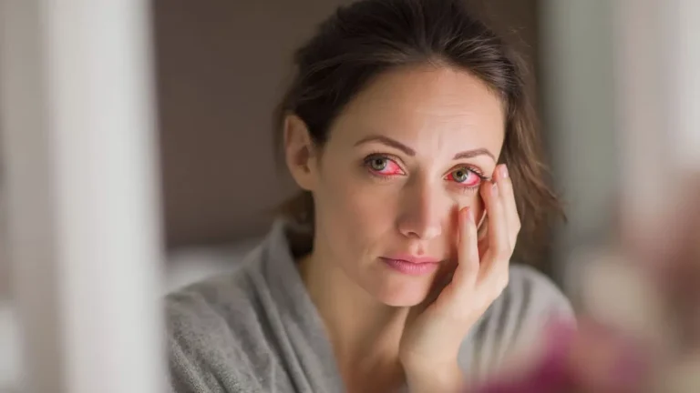 Sytë e skuqur pas zgjimit: Kur është normale dhe kur duhet shqetësuar